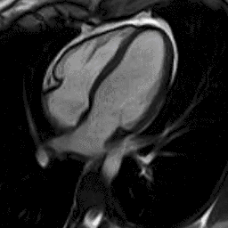 Μαγνητική Τομογραφία Καρδιάς - Heart MRI